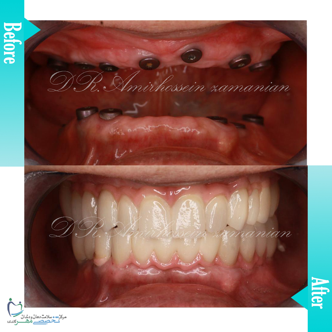 دکتر امیرحسین زمانیان متخصص پروتز های دندانی